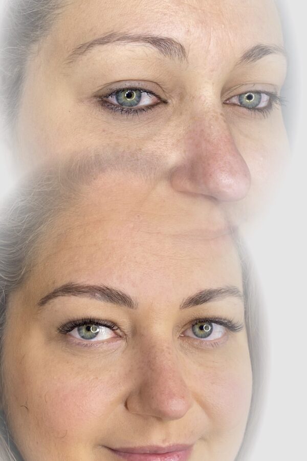 before and after healed brows